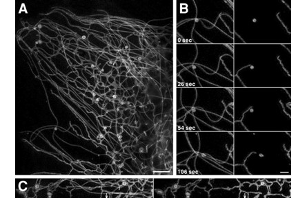 8.創(chuàng)建出可探測細(xì)胞內(nèi)結(jié)構(gòu)相互作用的納米和毫秒尺度成像技術(shù)