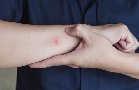 科普 | 人體是如何招致蚊子叮咬的，如何減少被叮咬？