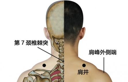 ?健康問(wèn)答 | 緩解頸椎“職業(yè)病”，如何進(jìn)行中醫(yī)調(diào)理？