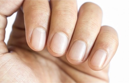 辟謠 | 指甲有豎紋，就是不健康？——指甲與健康