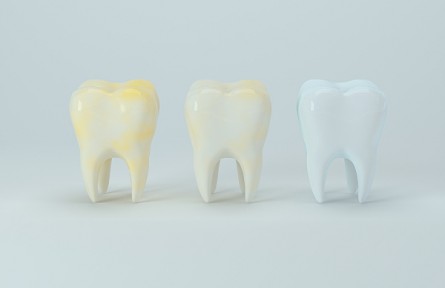 牙齒淡黃色才是健康色號？醫(yī)生提醒：洗牙并不能使牙齒變白