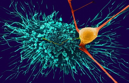 科技名詞|星形膠質(zhì)細胞 astrocyte