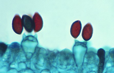 科技名詞|芽孢 spore，gemma